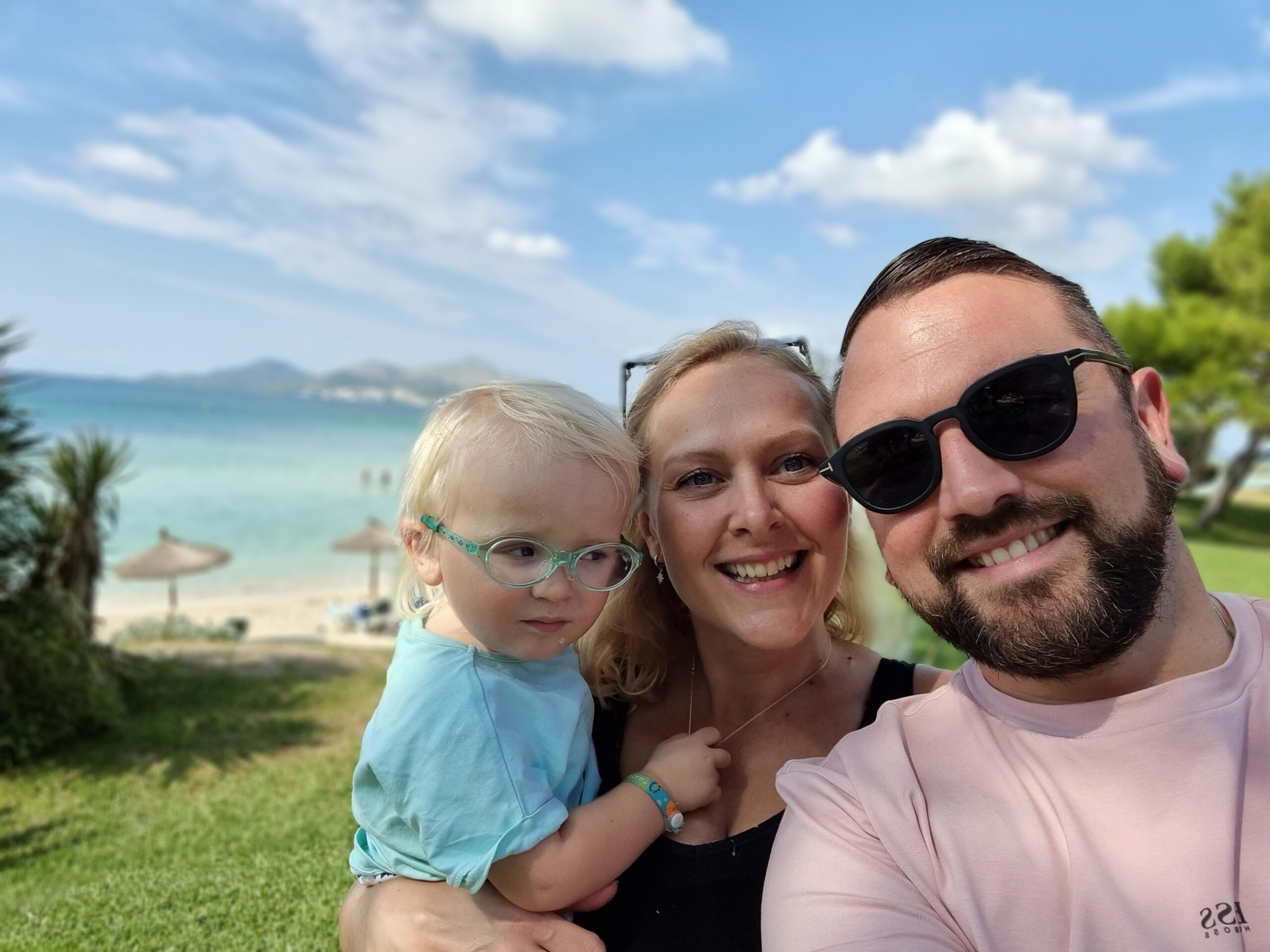 James’s nystagmus story